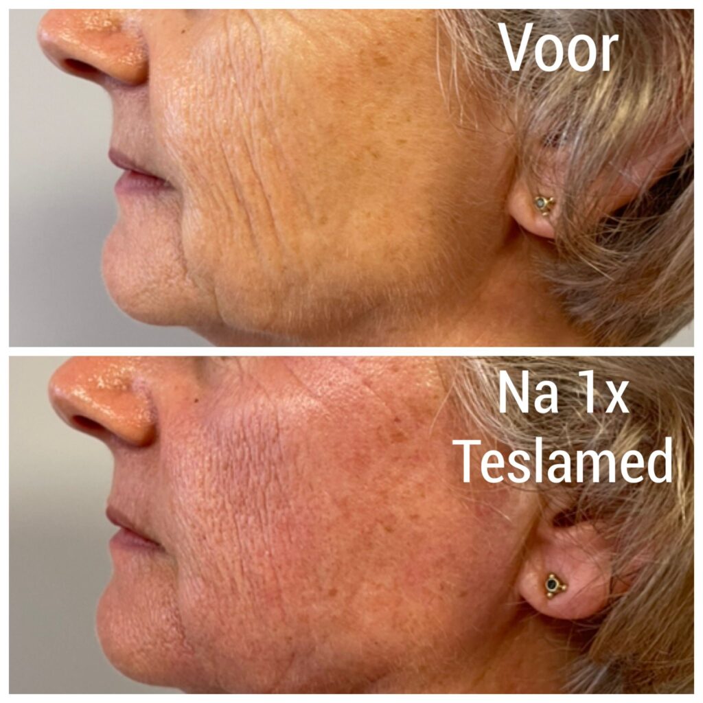 Tesla Med behandeling: kosten, ervaringen en resultaten op een rij